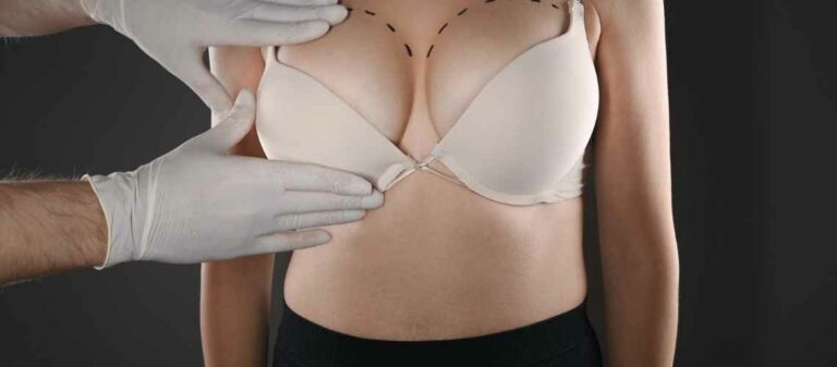 Breast Reduction Abroad