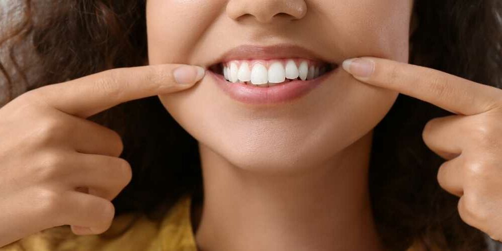Full Mouth Zahnimplantat Erfahrungen