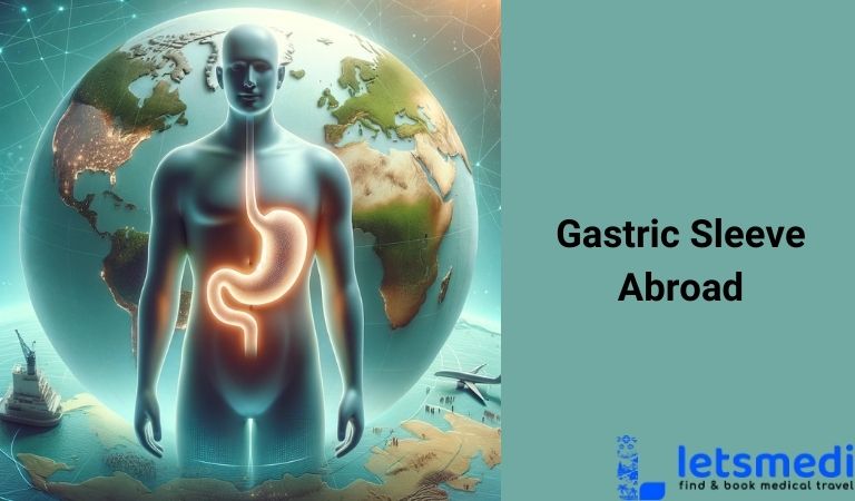 Gastric Sleeve Abroad