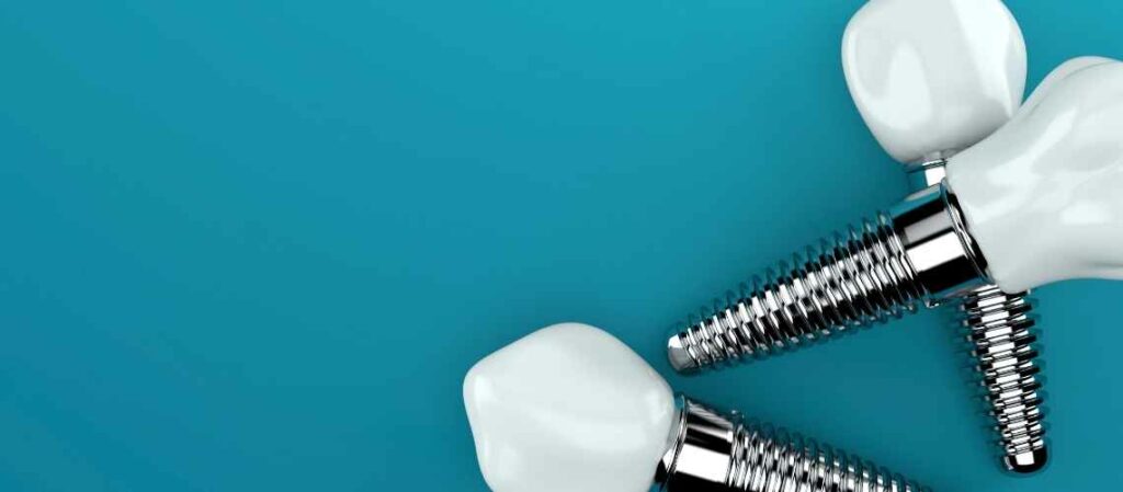 Ist All-On-4 Zahnimplantat im Ausland Günstig?