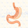 Gastric Sleeve in Istanbul, Turkey • Cost & Reviews