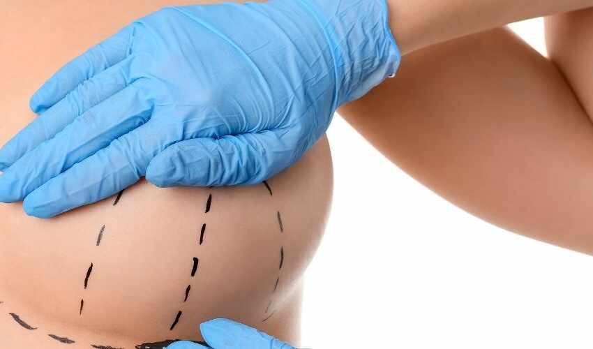 Breast Implants/Boob Job Cost in the UK