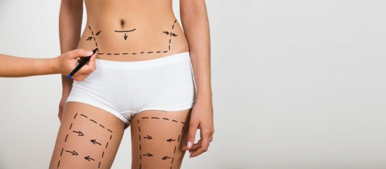 Liposuction Cost in UK