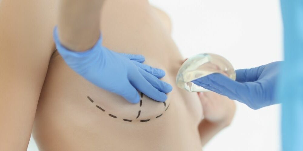Silicone Gel Breast Implants Cost in the UK
